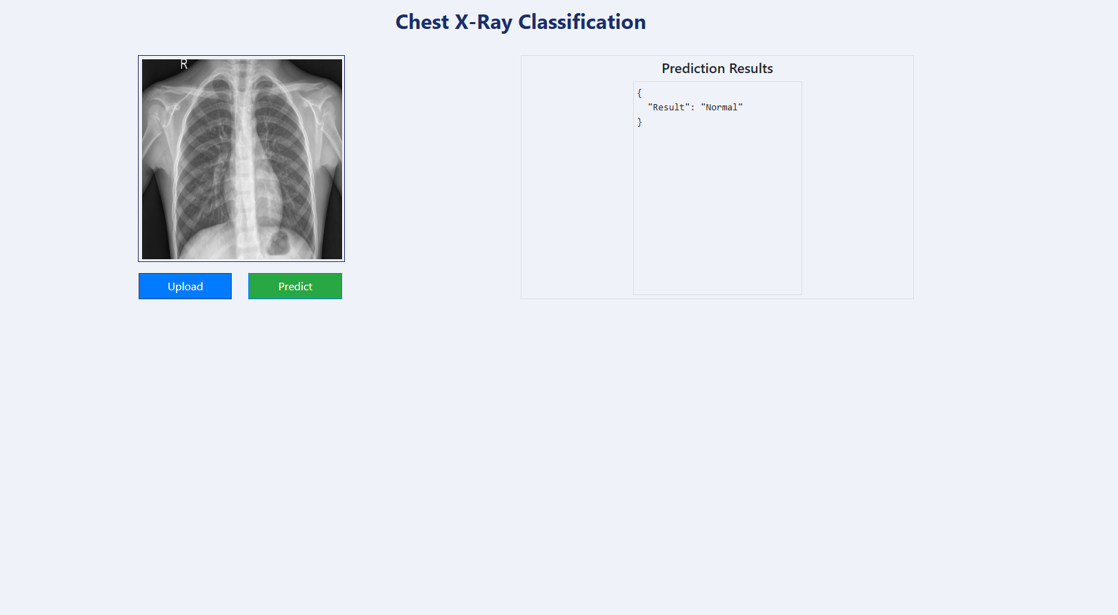 COVID Detection
